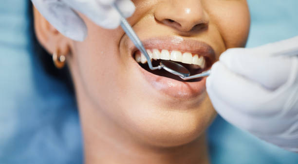 Best Emergency Dental Services for Seniors in Olathe, CO